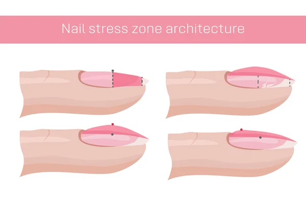 ネイルケア 爪のストレスゾーン 回復のアーキテクチャ マニキュア用のマニュアルのイラスト ネイルケア Vector — ストックベクタ