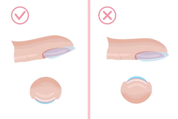 Cura Delle Unghie Tecnica Applicare Strato Base Manicure Giusto Sbagliato — Vettoriale Stock