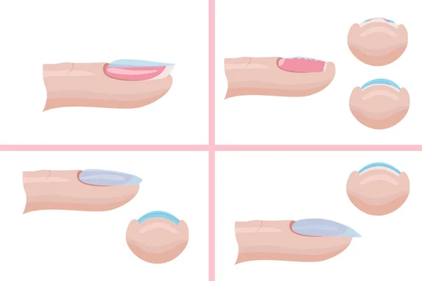 Cura Delle Unghie Tecnica Applicare Strato Base Manicure Errori Illustrazione — Vettoriale Stock