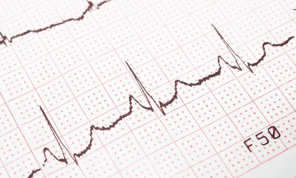 Electrocardiograma, impresión ECG, fondo EKG —  Fotos de Stock
