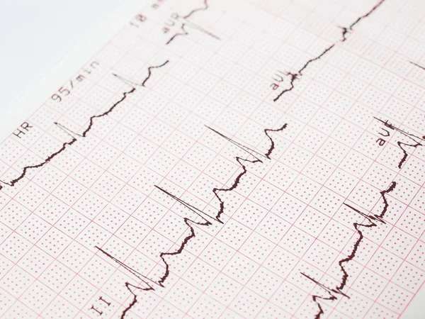 Elettrocardiogramma, stampa ECG, sfondo EKG — Foto Stock