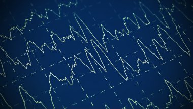 ondas cerebrales en electroencefalograma eeg para la epilepsia