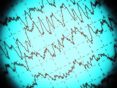ondas cerebrales en electroencefalograma eeg para la epilepsia