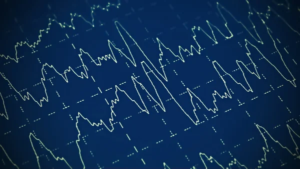 Onda cerebral no eletroencefalograma EEG para epilepsia — Fotografia de Stock