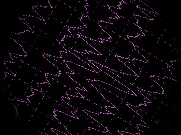 Hersenengolf op electroencephalogram eeg voor epilepsie — Stockfoto