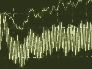 ondas cerebrales en electroencefalograma eeg para la epilepsia