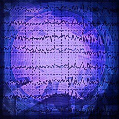beyin dalga electroencephalogram Eeg epilepsi, tasarım öğesi için üzerinde