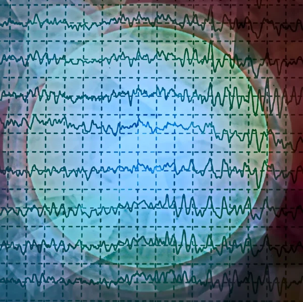 Onda cerebrale su elettroencefalogramma EEG per epilessia, elemento di design — Foto Stock