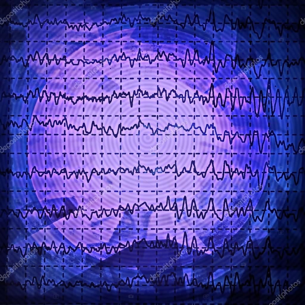 Brain wave on electroencephalogram EEG for epilepsy, design element