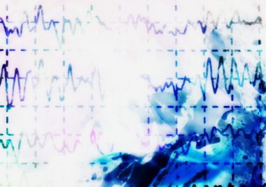 brain wave on electroencephalogram EEG for epilepsy, illustration clipart