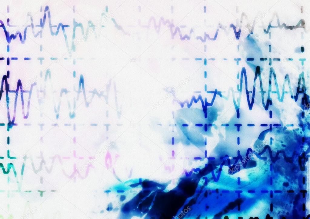 brain wave on electroencephalogram EEG for epilepsy, illustration