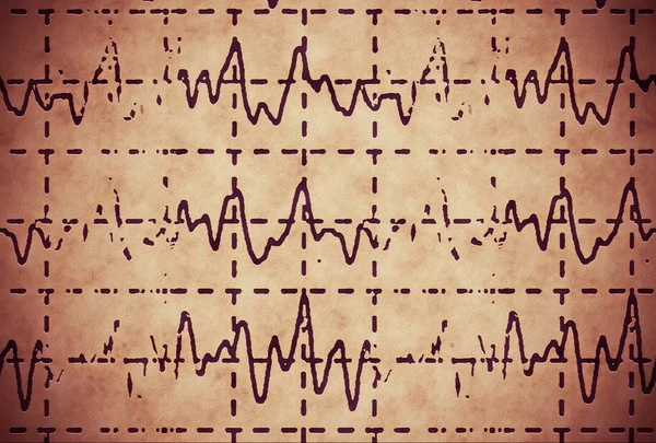 Onda cerebral no eletroencefalograma EEG para epilepsia, ilustração grunge fundo — Fotografia de Stock