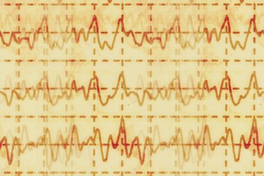 beyin dalga electroencephalogram Eeg epilepsi, illüstrasyon grunge arka plan için üzerinde