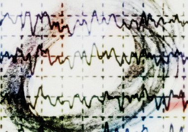 beyin dalga electroencephalogram Eeg epilepsi, illüstrasyon için üzerinde