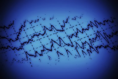ondas cerebrales en electroencefalograma eeg para la epilepsia