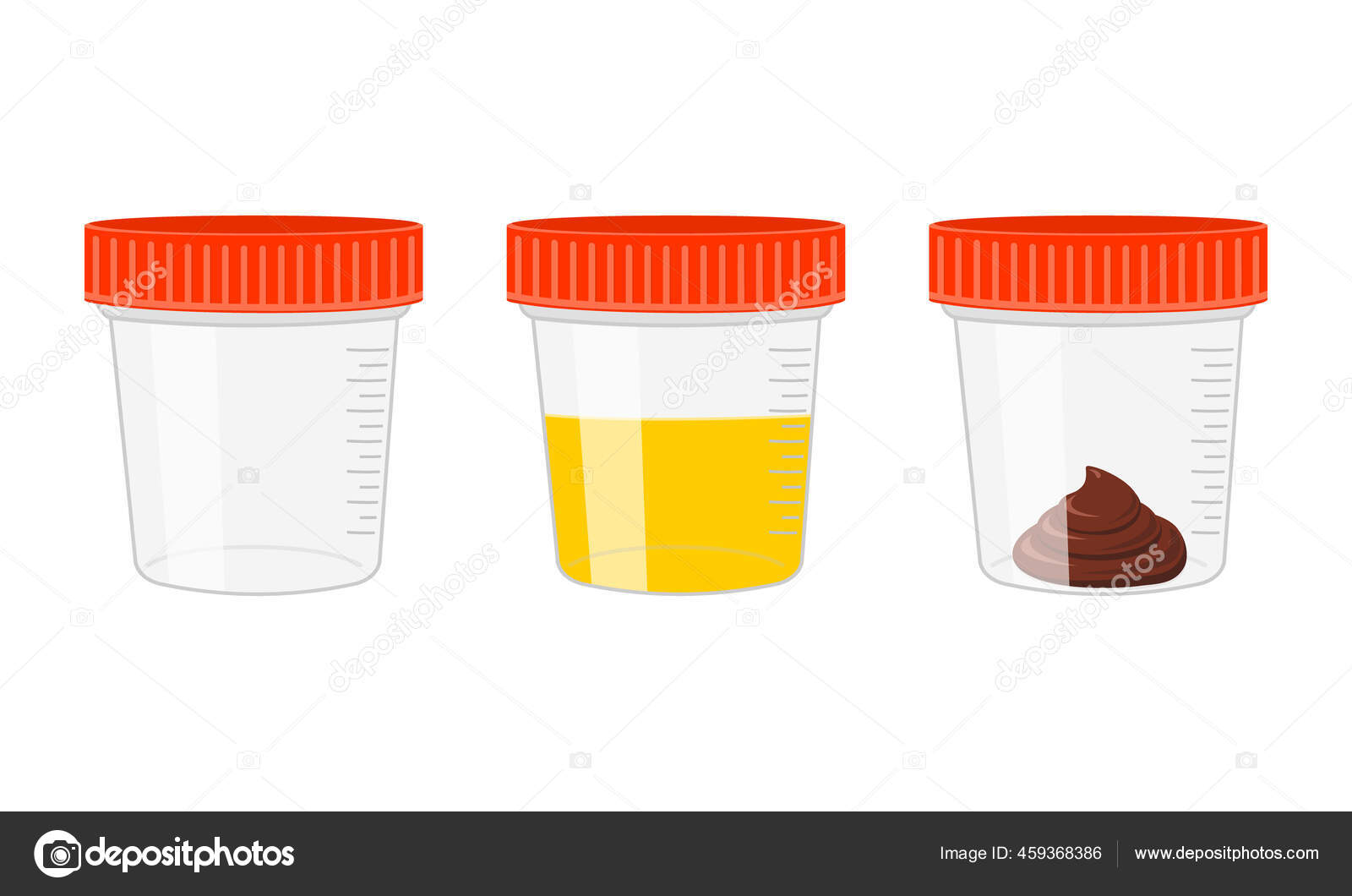 Urine and stool samples, empty and full plastic cups. Urinalysis, poo