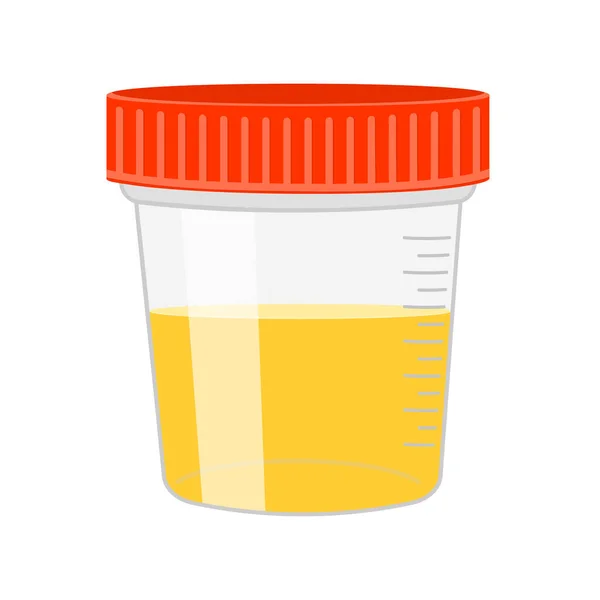 Analyse d'urine. Échantillon d'urine dans un contenant en plastique. Examen en laboratoire et concept de diagnostic. Illustration vectorielle de dessin animé — Image vectorielle