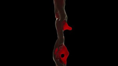 Kırmızı şarap dökülüyor, Luma Matte