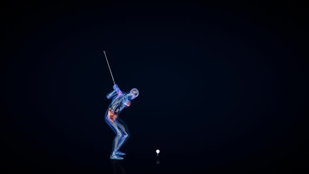 アスリートX線がゴルフボールを打つ 痛みの領域にズーム — ストック動画