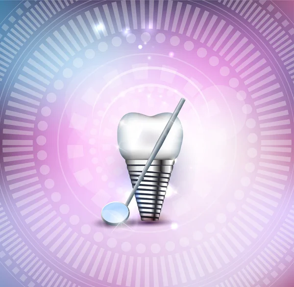 Diş implantı ve ayna — Stok Vektör