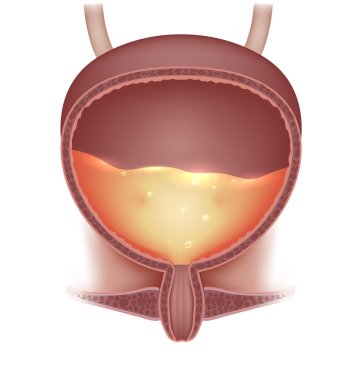 Urinary bladder with urine  clipart
