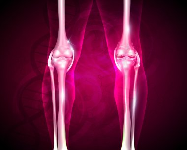 Osteoartrit, ağrılı eklem ve sağlıklı eklem