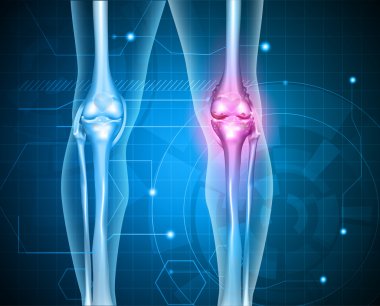 Knee pain abstract background clipart