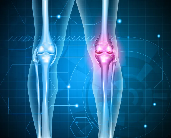 Dolor de rodilla fondo abstracto — Archivo Imágenes Vectoriales