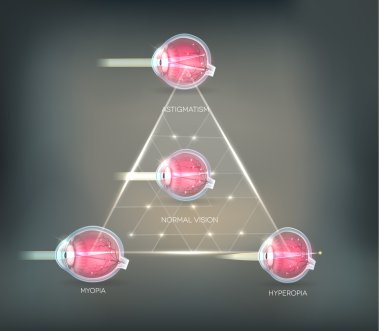 Göz görme bozuklukları üçgen arka plan