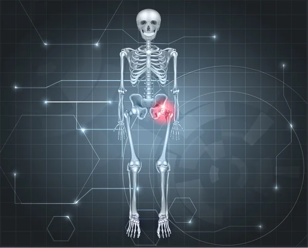 Skelett mit Hüftgelenkschmerzen — Stockvektor