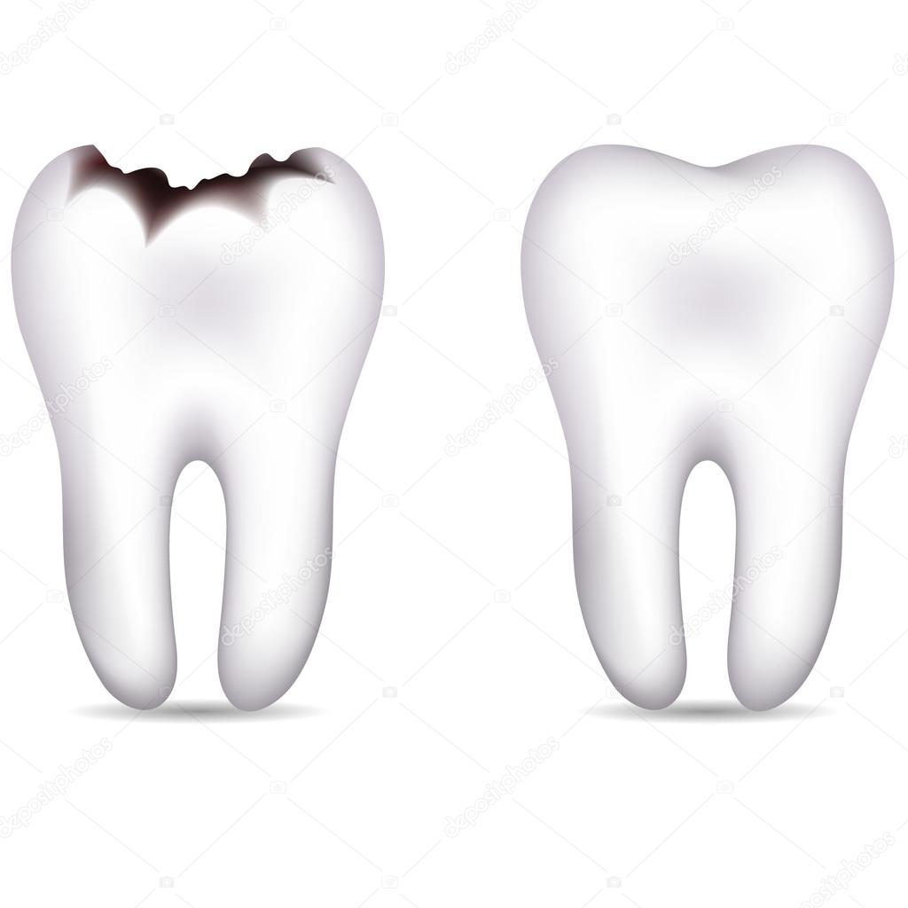 Tooth with caries and healthy tooth
