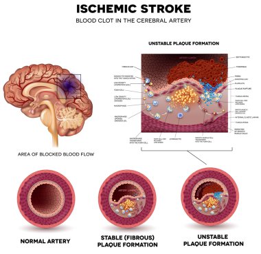 inme