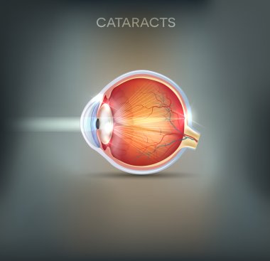Cataracts abstract grey background clipart