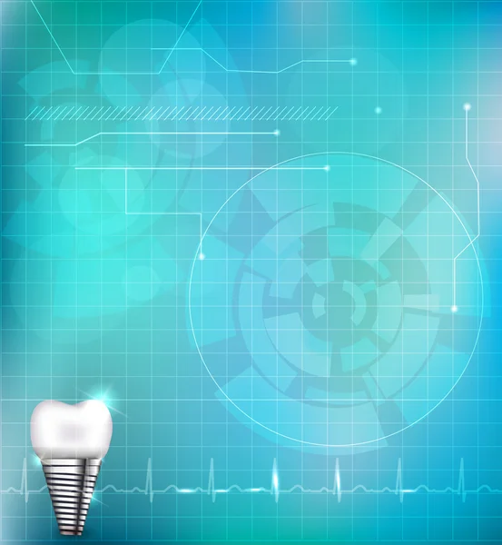 Contexte de l'implant dentaire — Image vectorielle