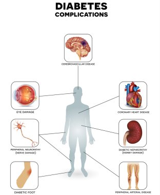 Diyabet komplikasyonları etkilenen organ