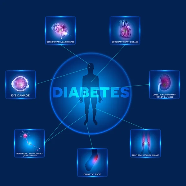 Diabetes órganos afectados — Vector de stock