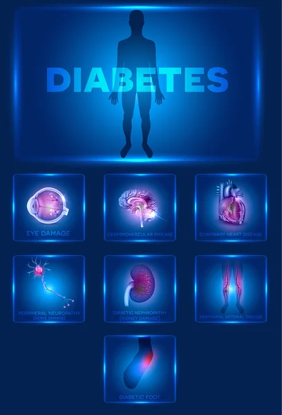Diabetes affected organs — Stock Vector