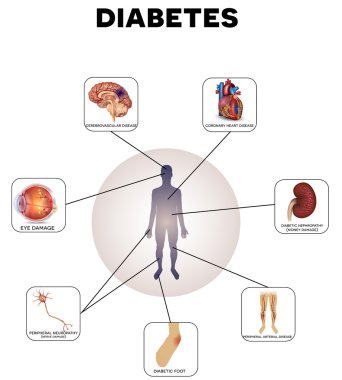 Diyabet komplikasyonları bilgi grafiği