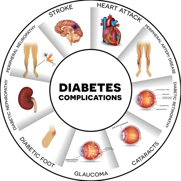 Diabetes complicaciones info gráfico — Vector de stock