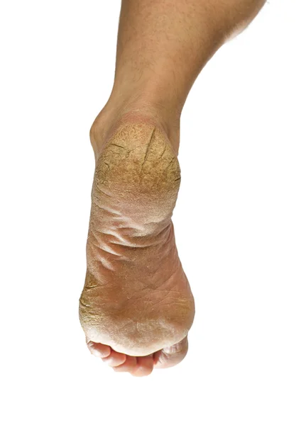 Değil bakımlı ayak