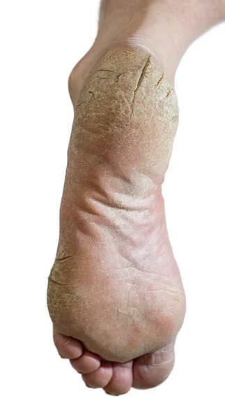 Değil bakımlı ayak