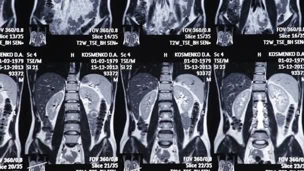 I raggi X sono un tipo di radiazione elettromagnetica, proprio come la luce visibile. Una macchina a raggi X invia singole particelle di raggi X attraverso il corpo . — Video Stock