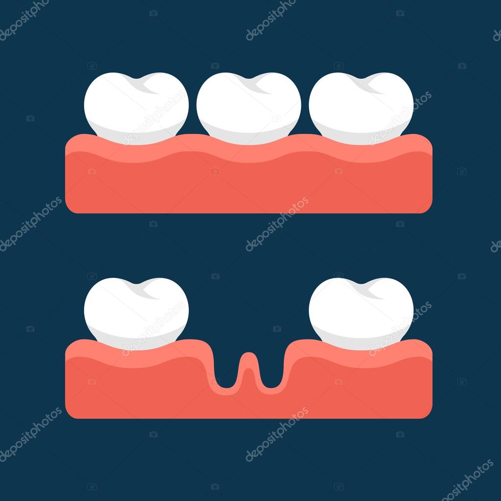 Teeth with Gum for Healthcare. Vector