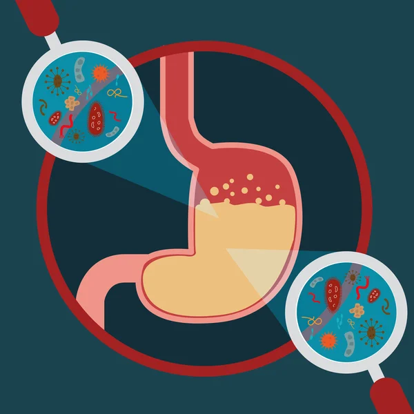 Investigar la infección estomacal — Vector de stock