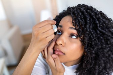 Kuru Gözler İçin Göz Damlası Uygulayan Genç Siyah Kadın. Kadın Kayganlaştırıcı Damlalar Kullanımı veya Kızıllık için Tıbbi Tedavi. Göz bakımı, oftalmoloji ve sağlık konsepti. İçerideki Güzel Kız Ayarları.