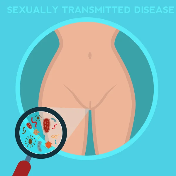 Maladies sexuellement transmissibles — Image vectorielle