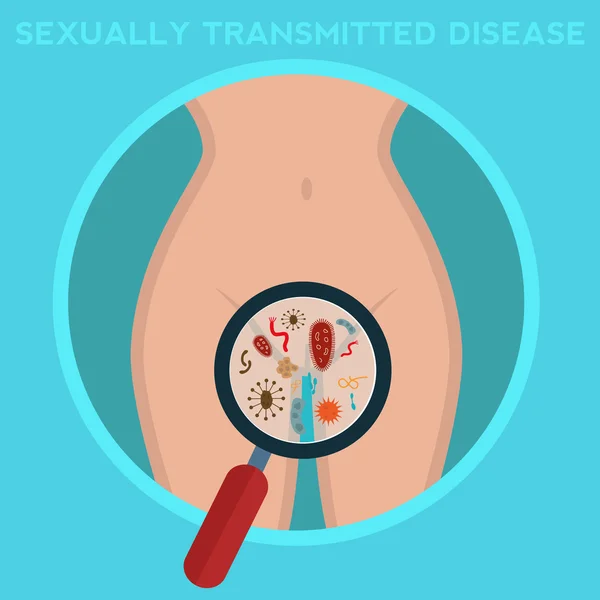 Maladies sexuellement transmissibles — Image vectorielle