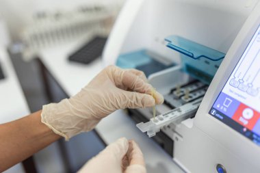 Female laboratory assistant making analysis with test tubes and analyzer machines sitting at the modern laboratory, lab tech loading samples into a chemistry analyzer