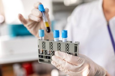 Kimyasal tüp geliştirme ve eczane laboratuvar, Biyokimya ve araştırma teknoloji kavramı.