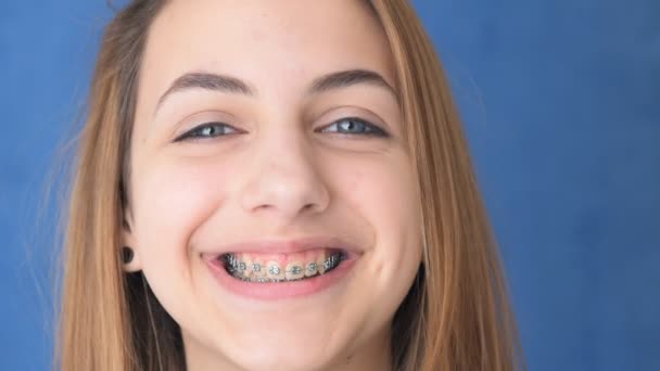 Bella ragazza sorridente con fermo per i denti lavarsi i denti  . — Video Stock